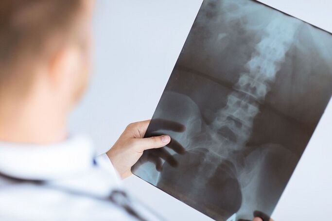 Nimme osteokondroosi diagnostilised võimalused