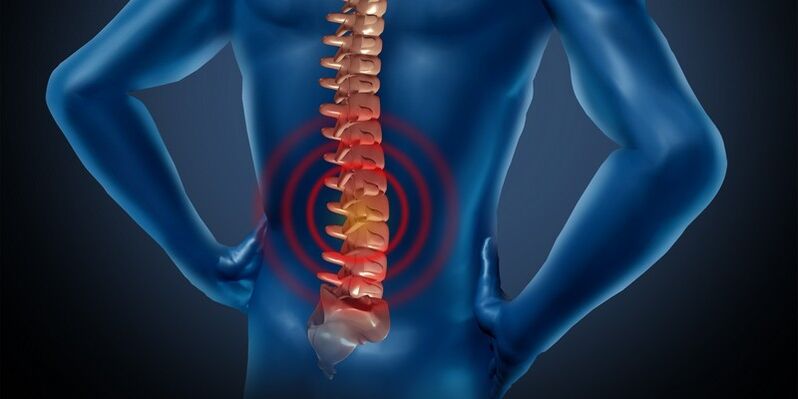 Nimmepiirkonna osteokondroos